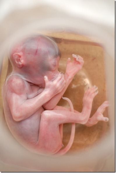 LTM - fetus