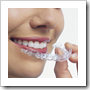 kawat gigi invisalign