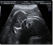 Image.US.1.12 Image.US.1.12