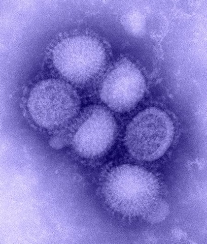 [B00528_H1N1_flu_blue_med[2].jpg]