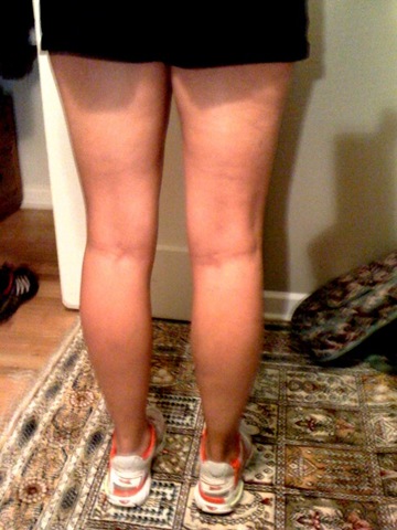 [legs pic 1[2].jpg]