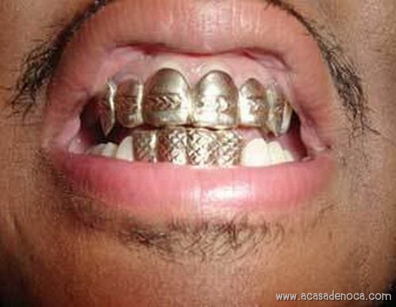 [thumbs_Grillz_014[8].jpg]