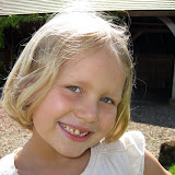 Evie with a Hanging Tooth - it came out five minutes later!