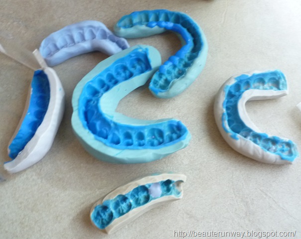 [OrchardScottsDentalTeethMouldsBEaute[2].jpg]