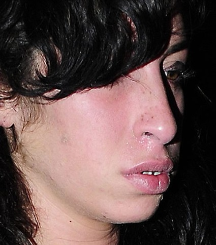 [post_image-amy-winehouse-coke-nose-01[3].jpg]