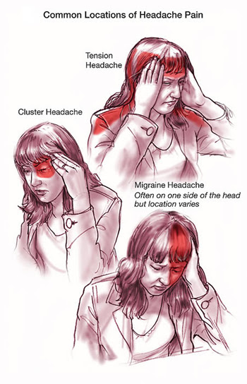 Headache