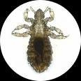head louse