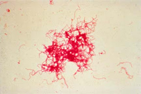 Haemophillus ducreyi