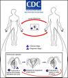 trichomoniasis