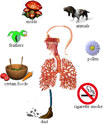 Asthma