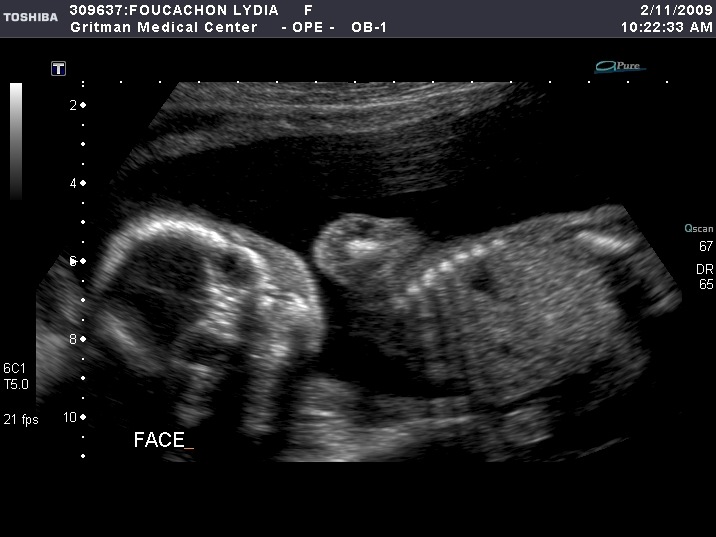 [baby[6].jpg]