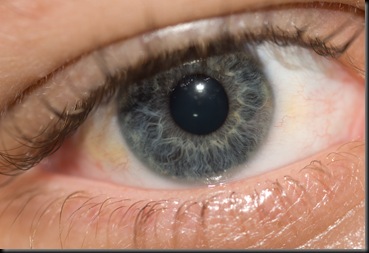 Eye (8 of 8)