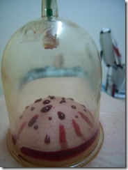 gambar bekam gambar bekam