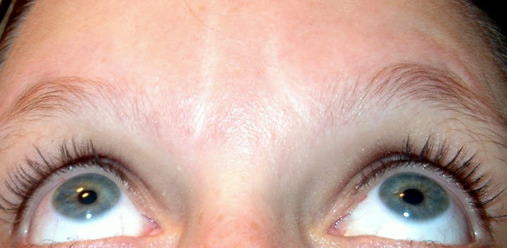 My frown lines