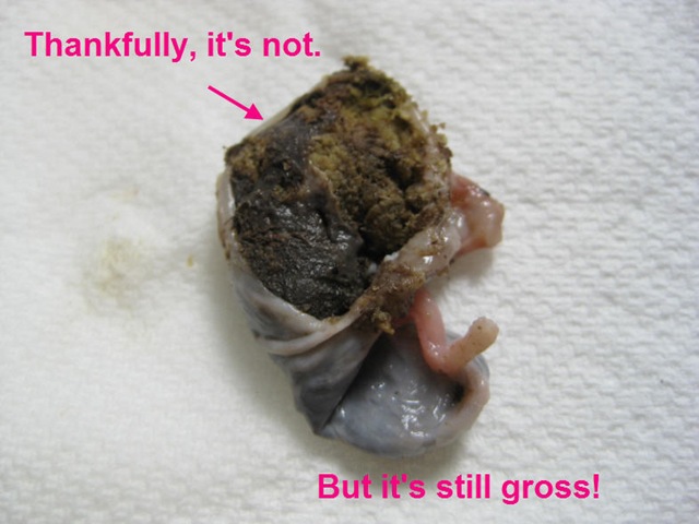 [Booskill_fetus_gross[8].jpg]