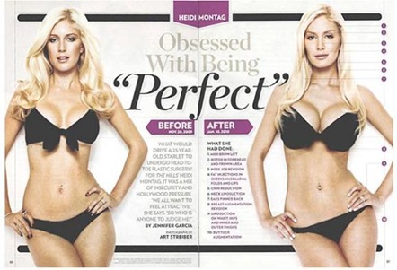 heidi montag after surgery. Heidi Montag Before and After