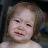 Erythema Multiforme