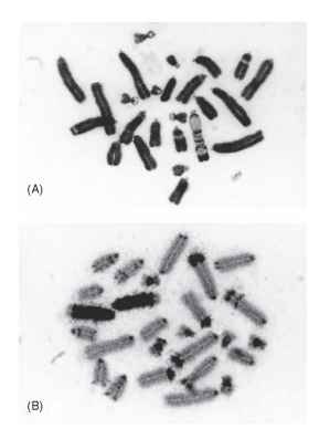 Monocentric chromosomes of the locust Chortoicetes terminifera, mostly acrocentric with some of the smaller ones sub-metacentric. (A) With one B chromosome, which is distinctively G-banded by a trypsin treatment that has produced comparatively minor effects in the A chromosomes. (B) With two B chromosomes showing positive C-banding for most of their length. The A chromosomes mostly have small centromeric C bands, but they show variable interstitial and distal C-banded segments.