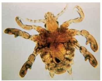 Crab louse. Pthirus pubis is broader than Pediculus spp., and resembles a crab.