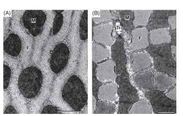 Transverse electron microscope sections through (A) a fiber with radial-)amellar fibrils (a flight muscle of the tettigoniid Euconocephalus nasutus) and (B) a fiber with columnar fibrils (from the tymbal muscle of the cicada Abricta curvicosta). The scale bars indicate 1 |im. Abbreviations: M, mitochondrion; F, fibril; Tr, intrac-ellular tracheole.