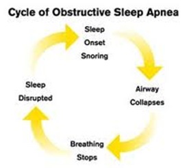 sleepapneacycle sleepapneacycle
