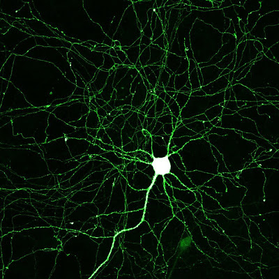 Hippocampal neuron expressing monomeric Green Fluorescent Protein (GFP). © Copyright 2004, Paul De Koninck. All rights reserved.