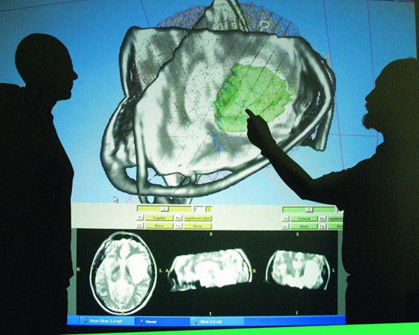[brain_surgery[4].jpg]