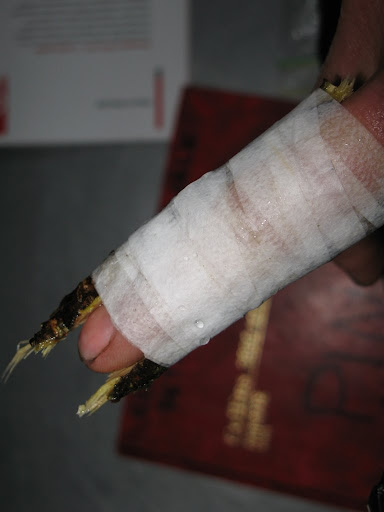 home made splint