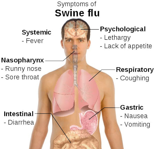 人感染猪流感症状