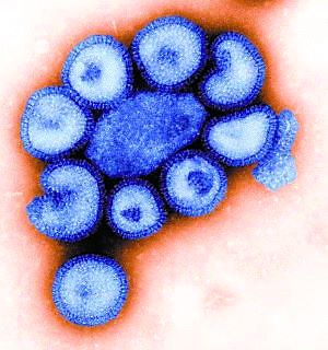 猪流感改称A/H1N1流感