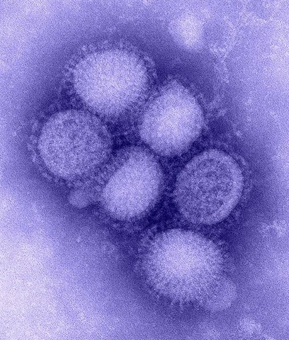 [509pxH1N1_influenza_virus[2].jpg]