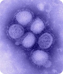 509px-H1N1_influenza_virus
