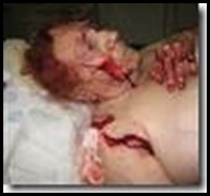This is our 'poster girl', Mrs Hettie Pretorius who survived torture in which her fingers were cut off. Her husband did not survive the cruel gang which attacked them in Naboomspruit in July 2008.