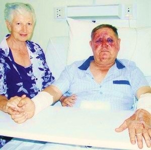 [Engelbrecht Charles and Violent attacked Magogong Hartswater NW Jan102010 Jane Engelbrecht Volksblad pic[5].jpg]