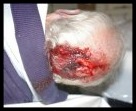 James Brown Alzheimer patient murdered in Kriel SAPS cell INJURY