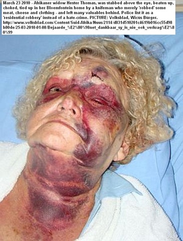 [Thomas Hester Beaten by armed thugs Bloemfontein Wicus Bürger Volksblad Mar242010[14].jpg]