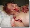[Rensburg_Van_Hettie_TorturedFingersCutOff_FarmAttackHusbandDeadJuly2008Naboomspruit[2].jpg]