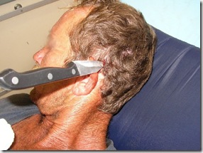 KnifeInHead_TraumaSocietyOfSouthAfrica_VictimPic