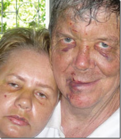 Dion and Talita Röder Ladysmith_BeatenUpByArmedGang