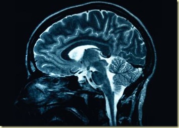 BrainScan university Erasmusmagazine nl