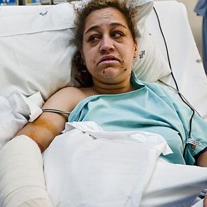 [Vosloo Ciandi Centurion Academy arm nearly cut off by cellphone robbers UnitasHospitalBeeldOct212009[5].jpg]