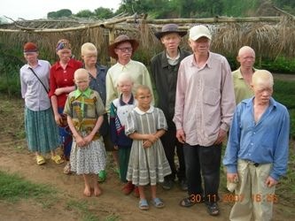 [Albinos_HelpBurundi[6].jpg]
