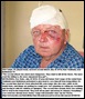 Lange Gert 67 attacked 2nd time Vaalbank farm Bethlehem July 22 2010 Beeld pic