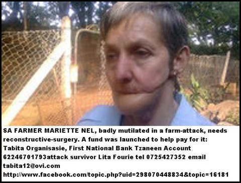 NEL Farmer Mariette injured panga attack FUNDRAISER reconstruction face Tabita Organisation