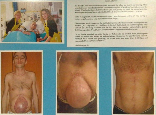 [Albarran Nelson SA crime victim survivor Milpark Trauma ICU April262006[9].jpg]