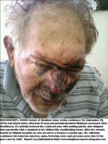 [Bronkhorst Chris after vicious attack before  hospitalisation[8].jpg]