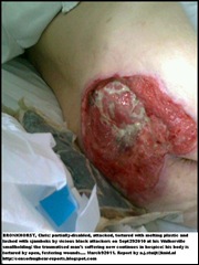 Bronkhorst Chris attack victim maltreatment in hospice infected sores