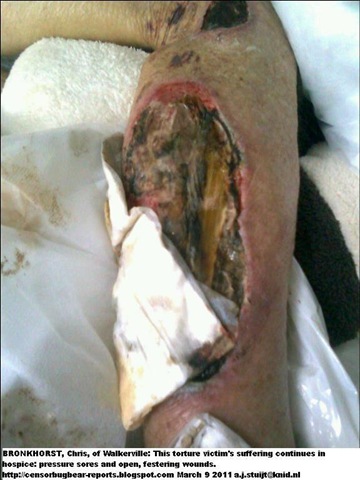 [Bronkhorst Chris maltreatment hospice attack victim dies April242011[4].jpg]