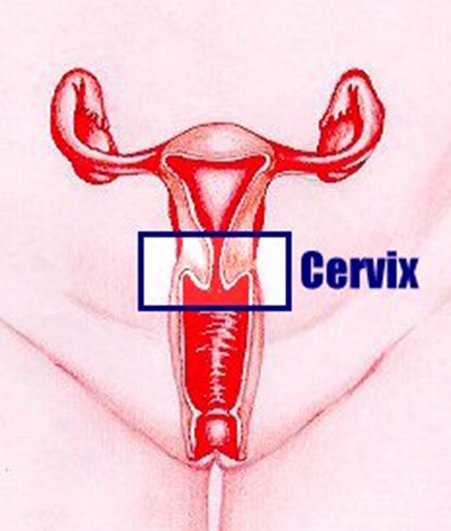 [cervix[1].jpg]