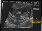 echo15aout_04.jpg